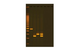 Edvotek™ Water Quality Testing III: Multiplexed PCR for Testing Water Bacteria