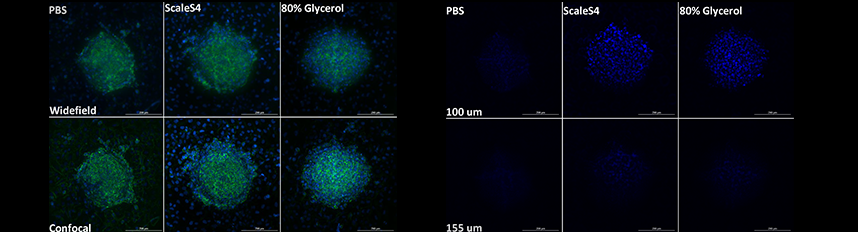 Optical Clearing for Improved Confocal Imaging of Thick Specimens